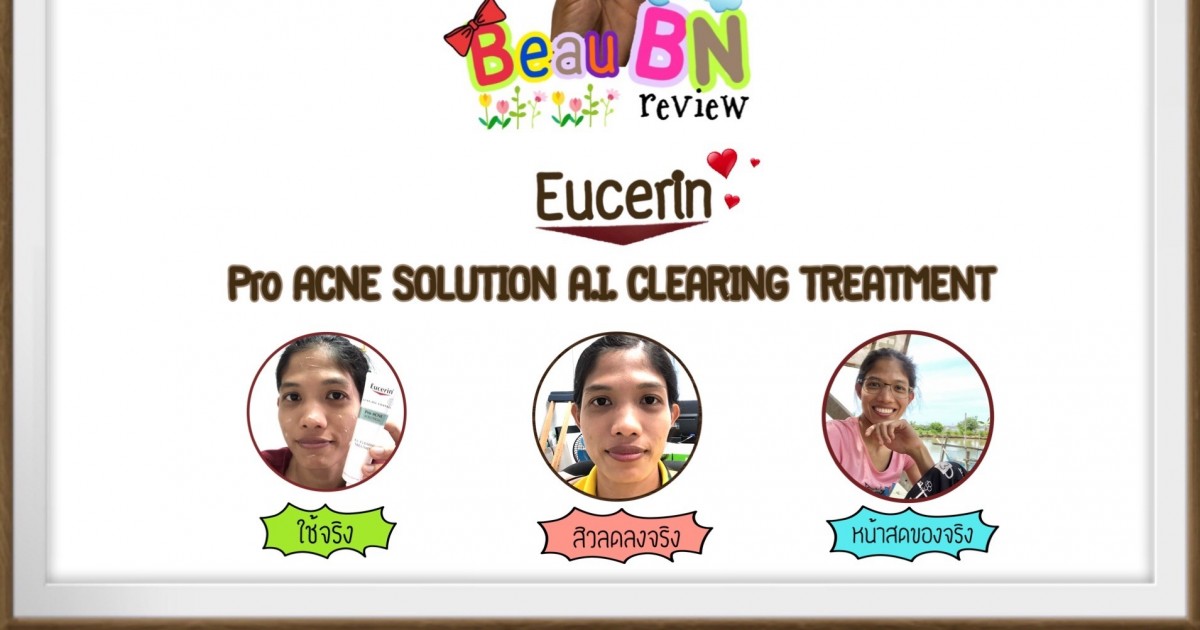 Eucerin Pro ACNE SOLUTION A.I. CLEARING TREATMENT ตัวช่วยจัดการสิวบนใบหน้า