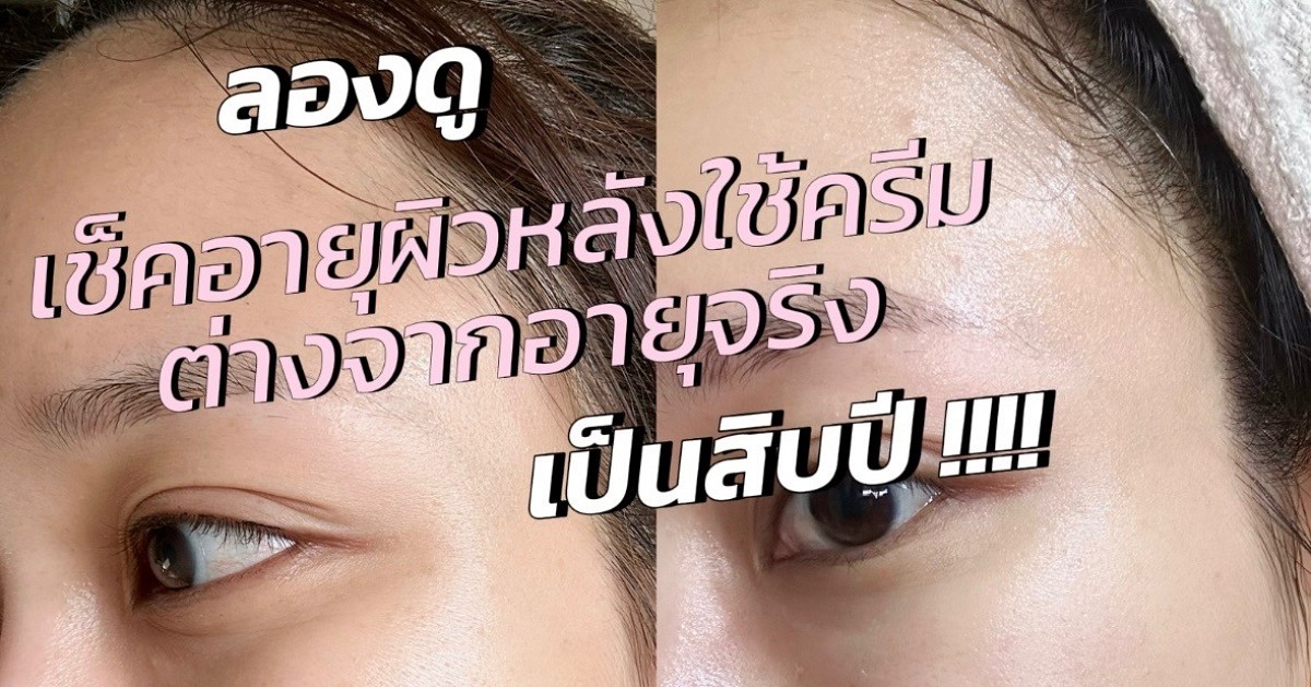 เราลองเข้าไปใช้แอพเพื่อตรวจสภาพผิวหลังจากที่ลองใช้ครีมทาฝ้า Melamii ผลออกมาอายุผิวลดลงเป็นสิบปี !!