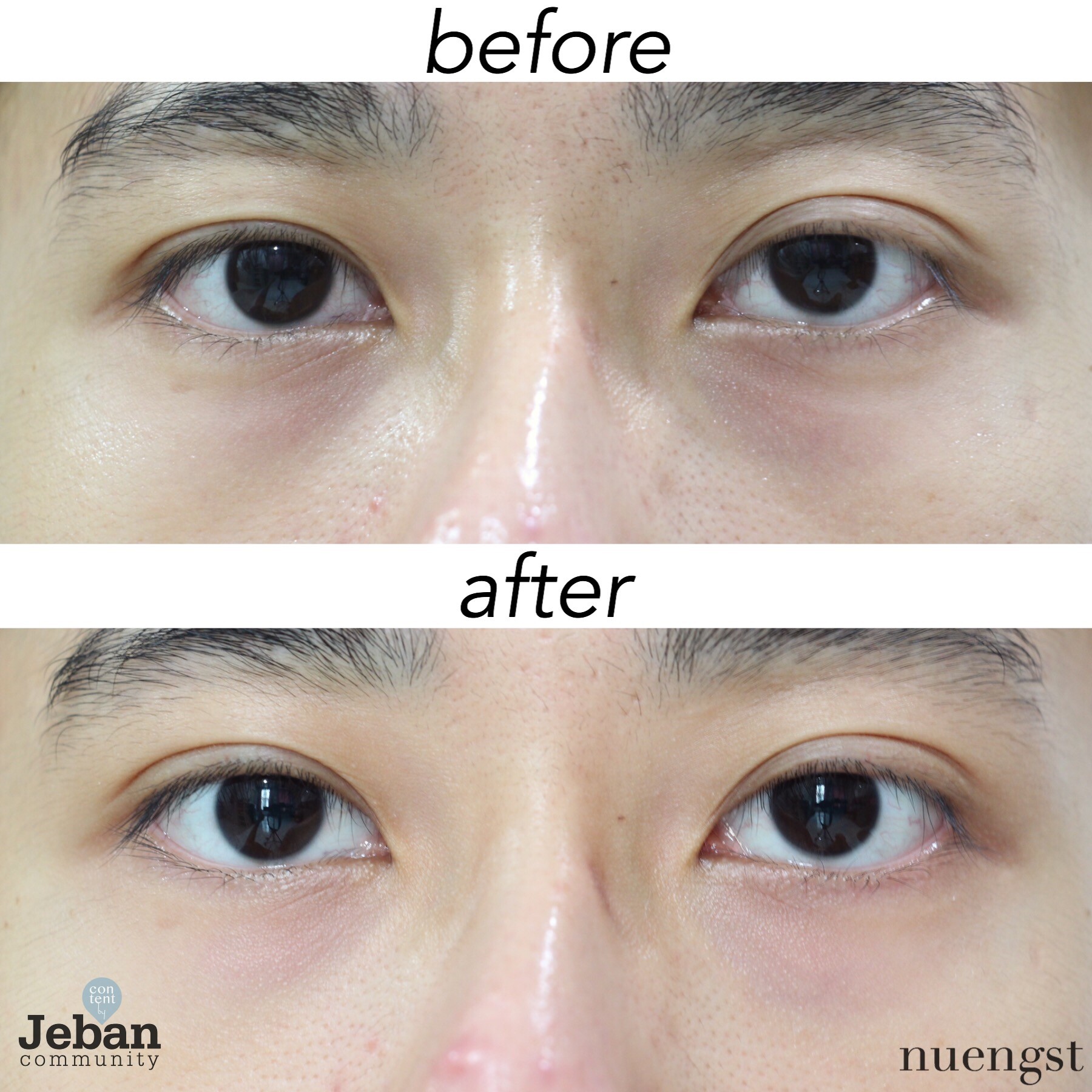 อัพเดท 14 วันกับการใช้ Vichy Mineral 89 Eyes