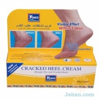 Cracked Heel Cream